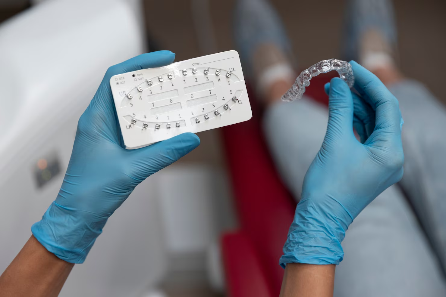 Clear Aligners