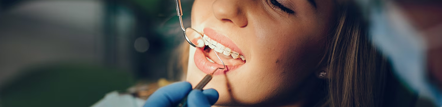 Braces Banner