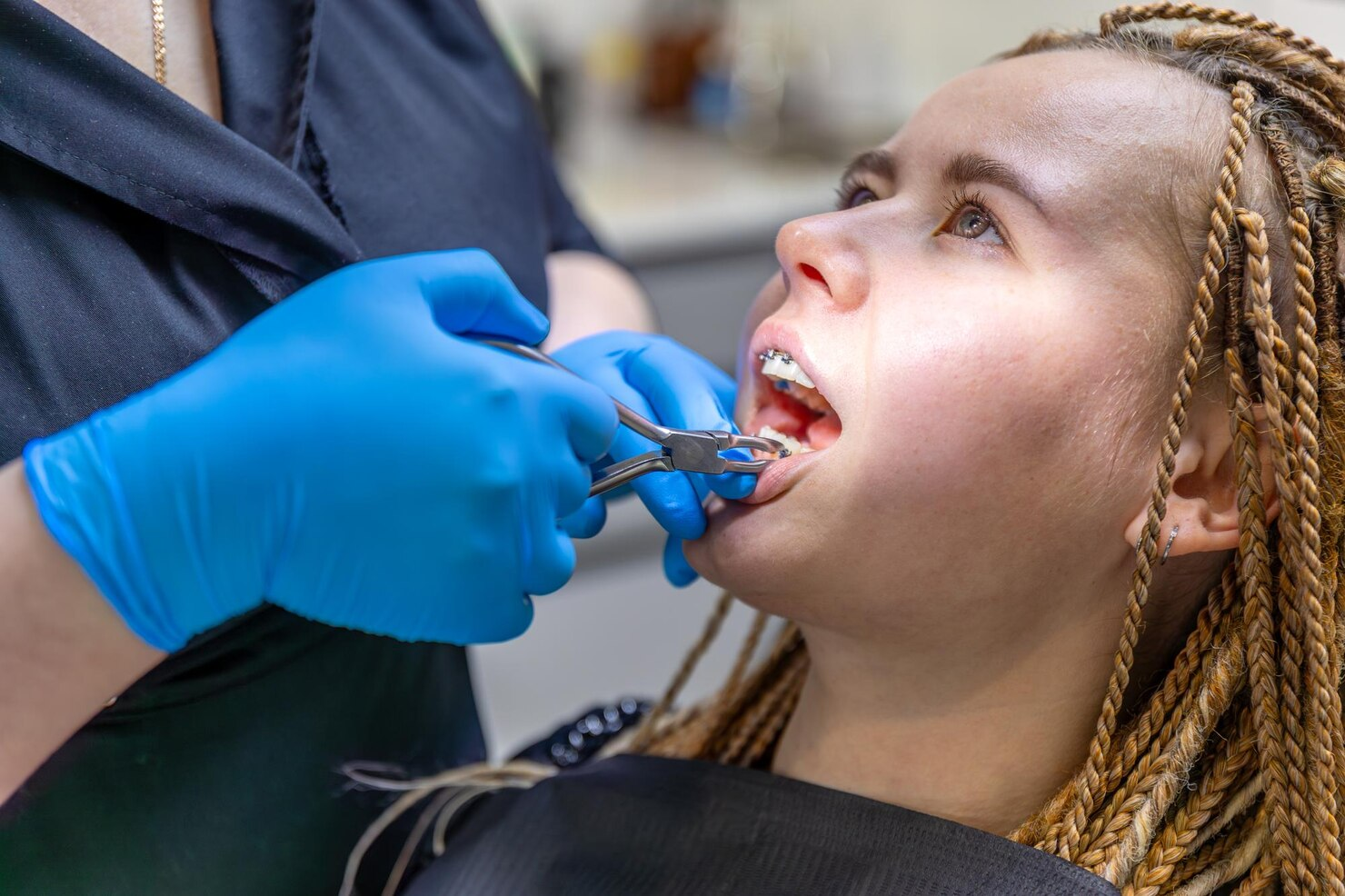 Braces Consultation