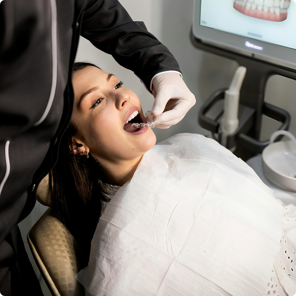 Clear Aligner Fitting