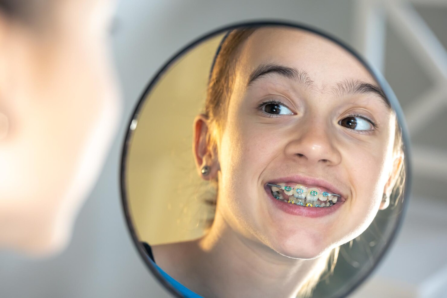 Braces Teens