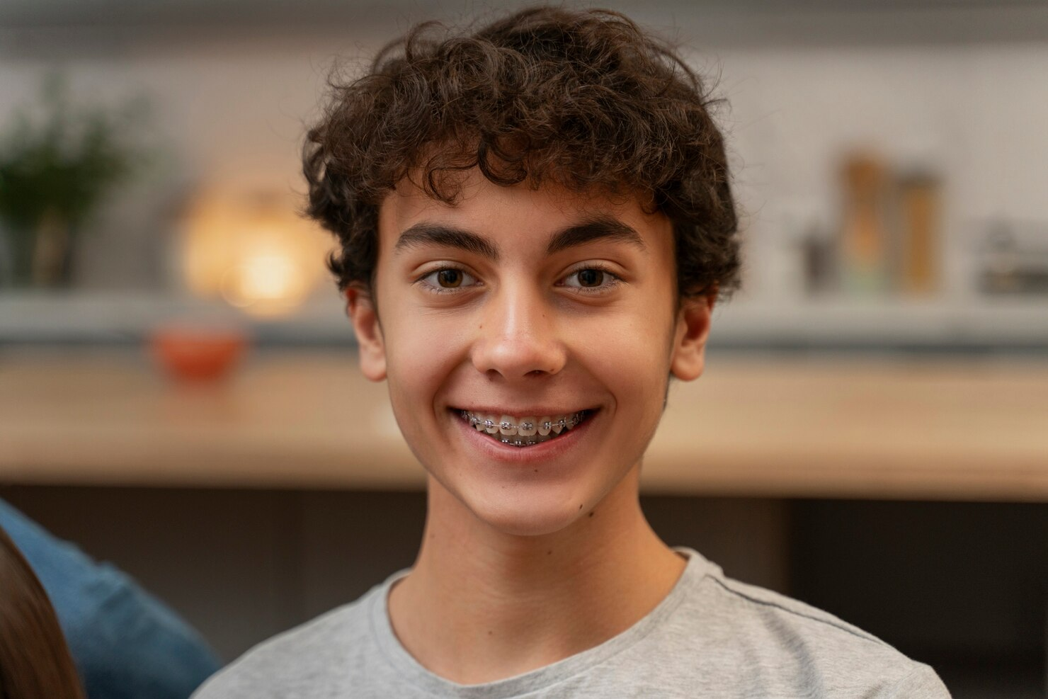 Teen Braces Treatment