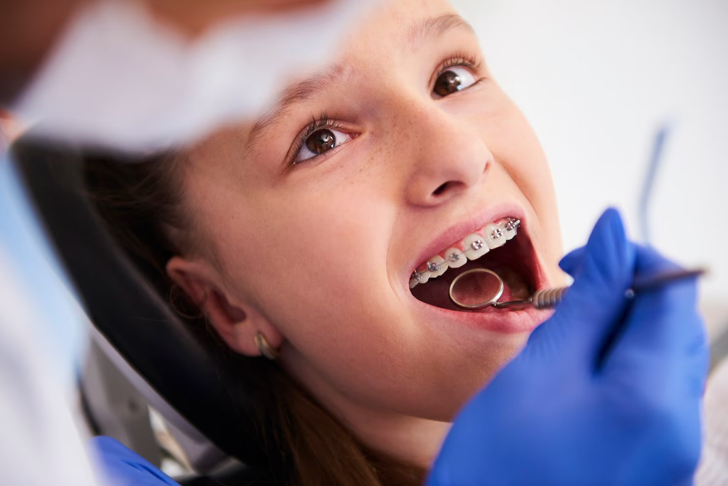 Orthodontic Checkup
