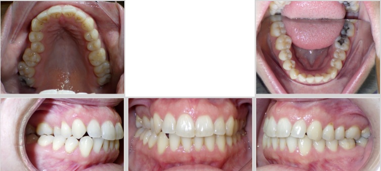 Kelly G Before